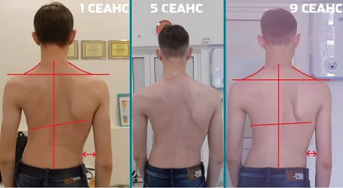 Улучшилась осанка и самочувствие в целом!